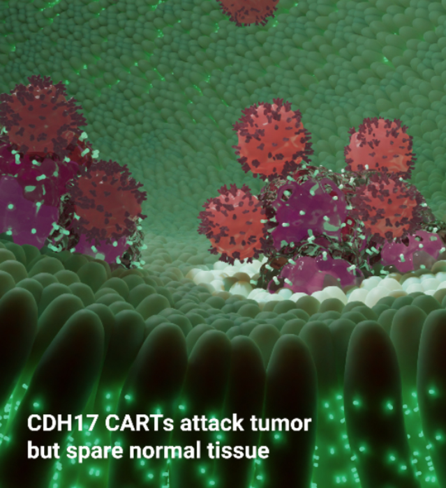 CDH17 CARTs attack tumor but spare normal tissue