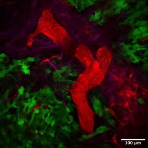 Microscopic view inside mouse model of pancreatic cancer tumour using intravital imaging at Garvan's ACRF Incite Centre.