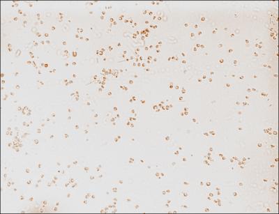 Brown Tide, <i>Aureococcus anophagefferens</i> Cells