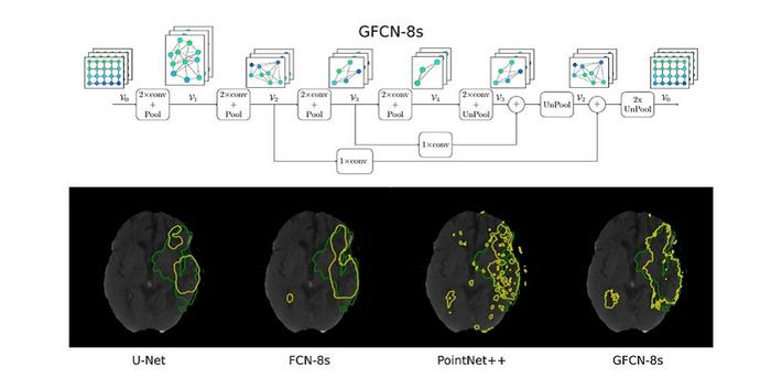 GFCN-8s, the proposed geometric deep learning network with three pooling layers and eight-fold upsampling, can extract rich geometric information from computed tomography scans of the brain.