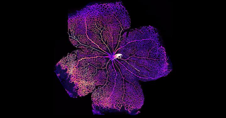 Blood vessels in the retina