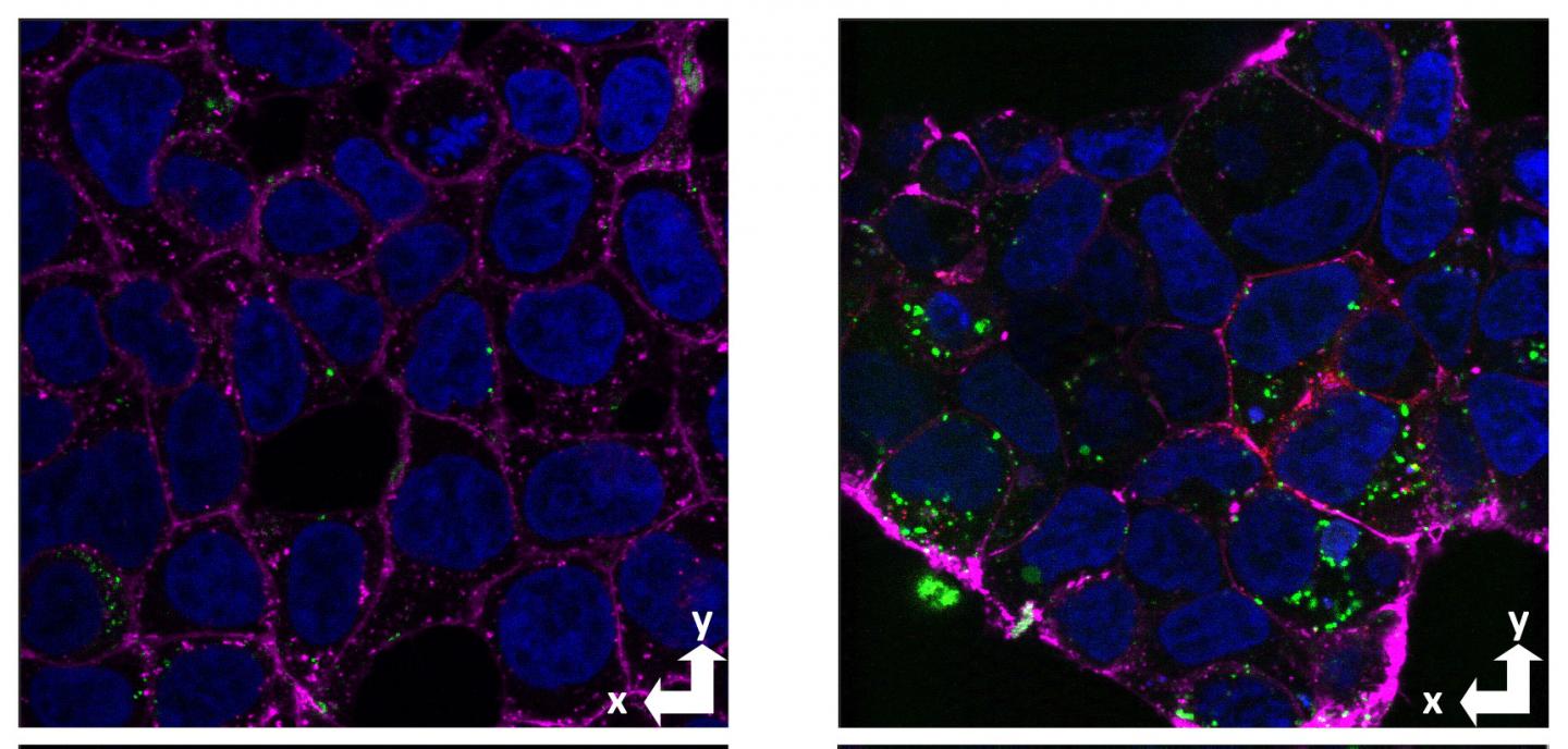 Amyloid Beta Uptake