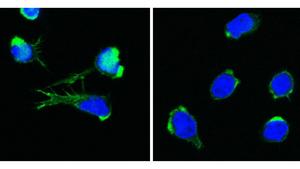 healthy and DOCK11-deficient T cells