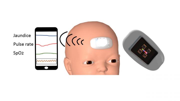 First wearable device can monitor jaundice-causing bilirubin and vitals in newborns