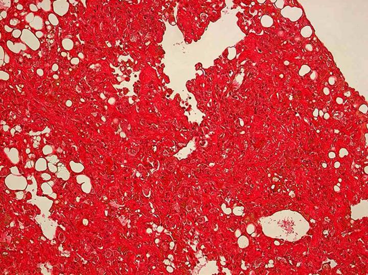 Samples from Mouse Lungs