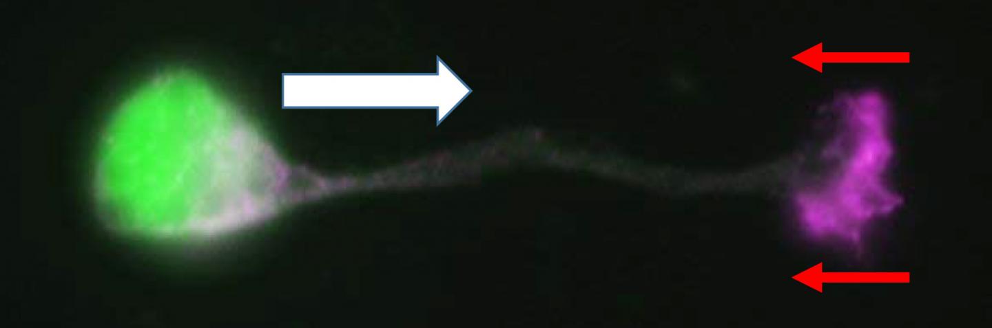 Image: At the Tip of the Neuronal Leading Process