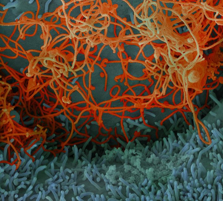 Ebola Virus Image