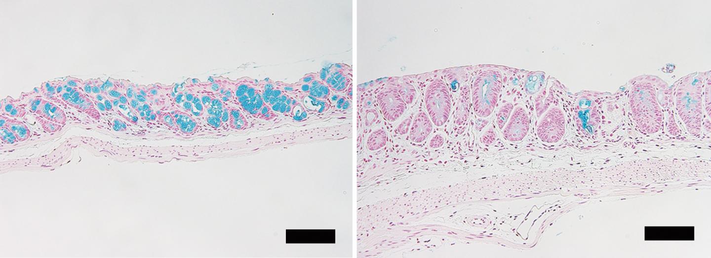 The Goblet Cells in Mice Large Intestine