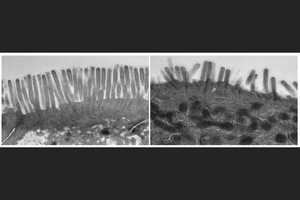 Microvilli