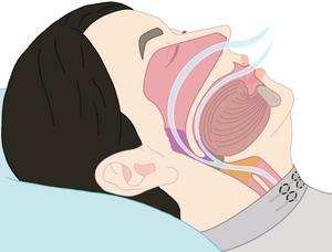 Scientists develop ‘smart pyjamas’ to monitor sleep disorders