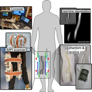 The iMPI Scanner