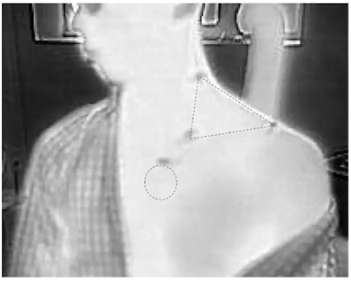 Infrared thermography image of a participant