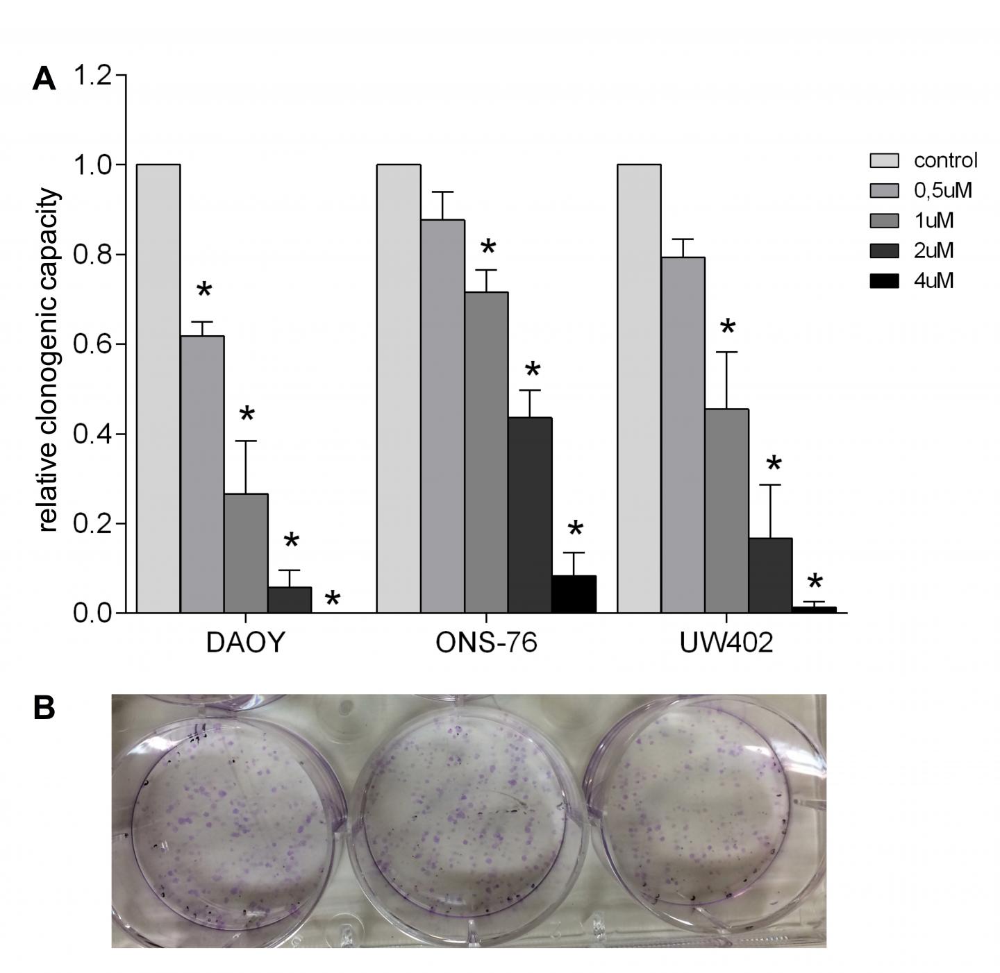 Leukemia drug and pediatric brain câncer