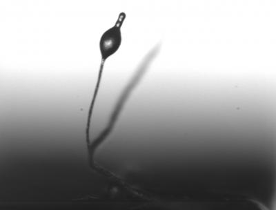 Amoeba Fruiting Body (2 of 2)