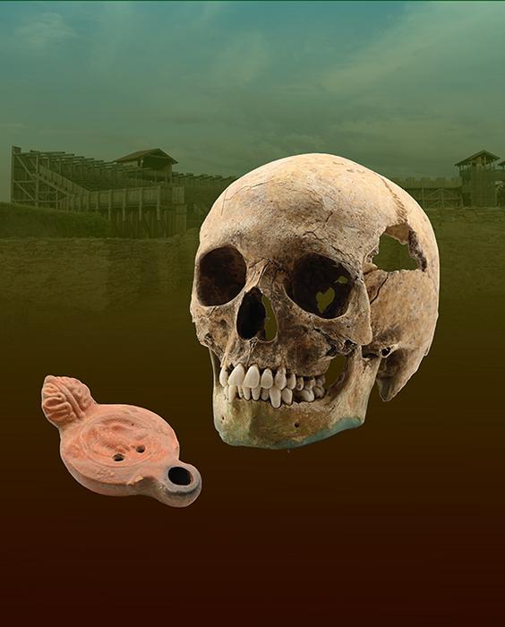 Skull of a South-Saharan African individual