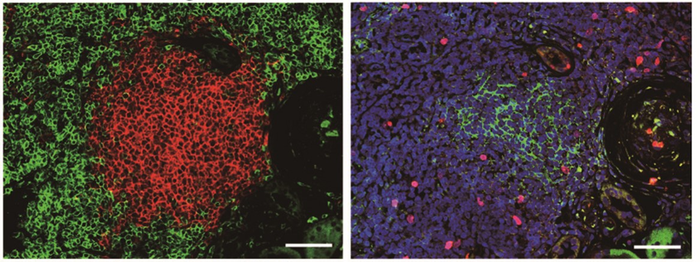 Predicting the success of kidney transplantations