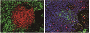 Predicting the success of kidney transplantations