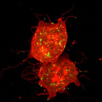 Cells with Long Cytonemes -- the Protrusions Which Carry Wnt Protein