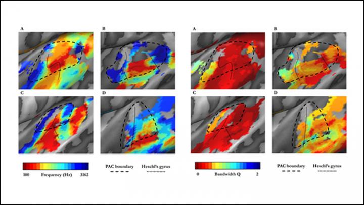 Tonotopic & Tuning Width Maps