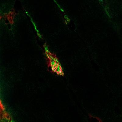 New Target for Muscular Dystrophy Drug Therapy