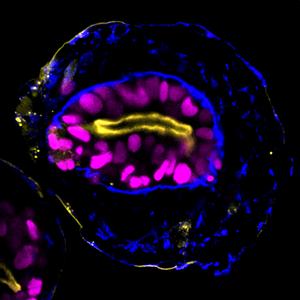 Day 4 embryoid