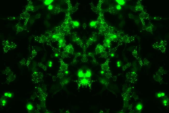 Cells expressing a mutant protein involved in motor neurone disease pathology