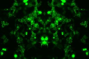 Cells expressing a mutant protein involved in motor neurone disease pathology