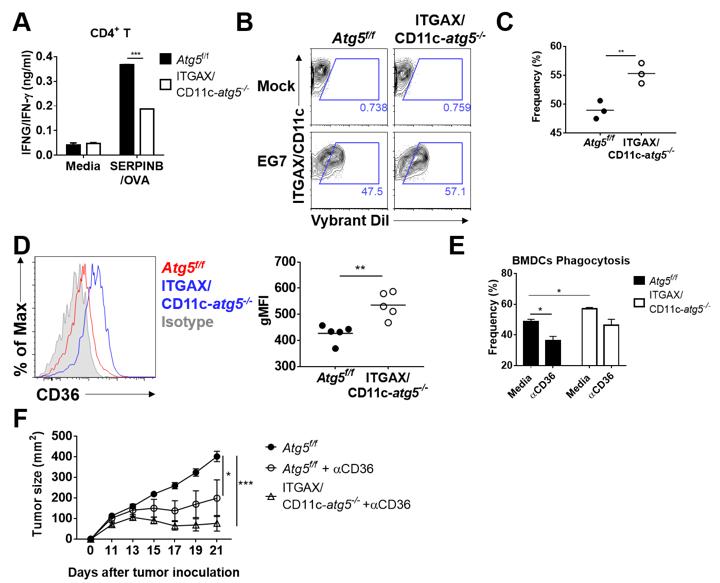 Role of Autophagy in Dendritic Cells