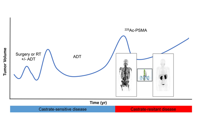 Current known landscape of treatment of prostate cancer.