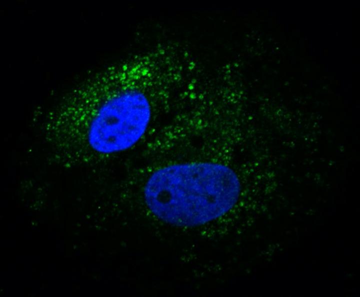 Glycoprotein Staining in Vero E6 Cells 