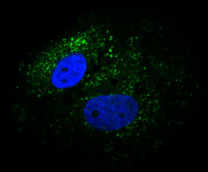 Glycoprotein Staining in Vero E6 Cells 
