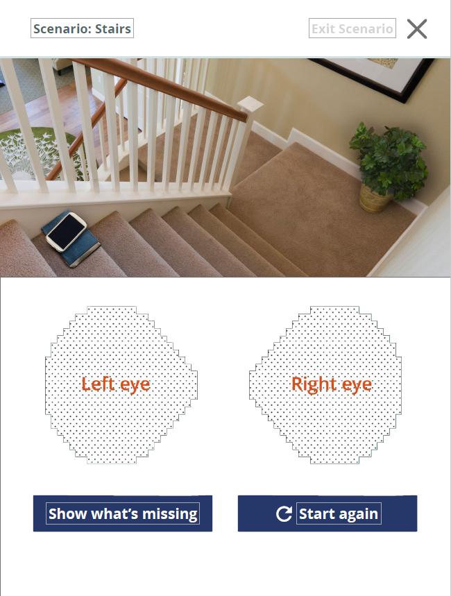 Screenshot from Glaucoma in Perspective app - stairwell
