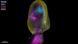 First map of human limb development reveals u | EurekAlert!