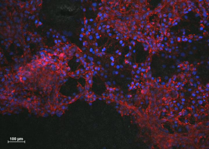 Neurons growing without ink