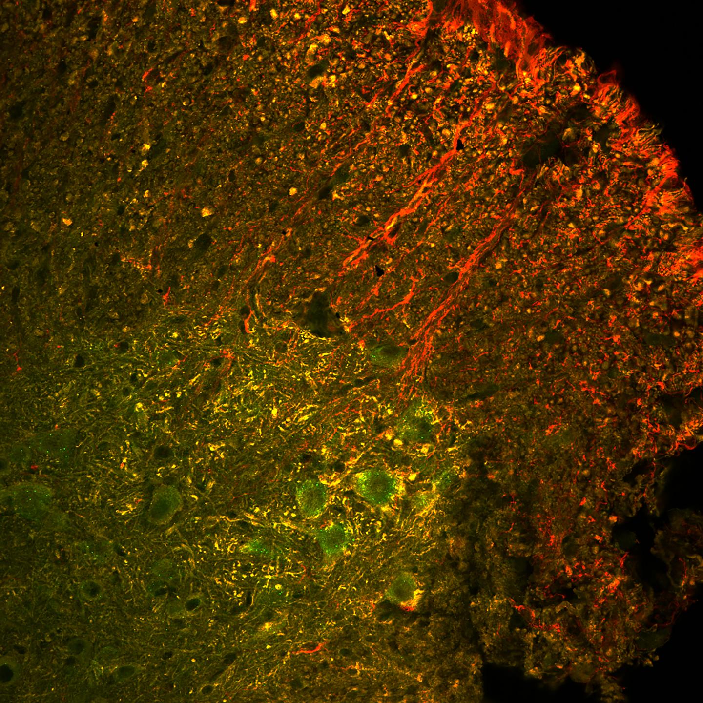 Gene-Editing Shows Promise in Mouse Models of Lou Gehrig's Disease (1 of 2)