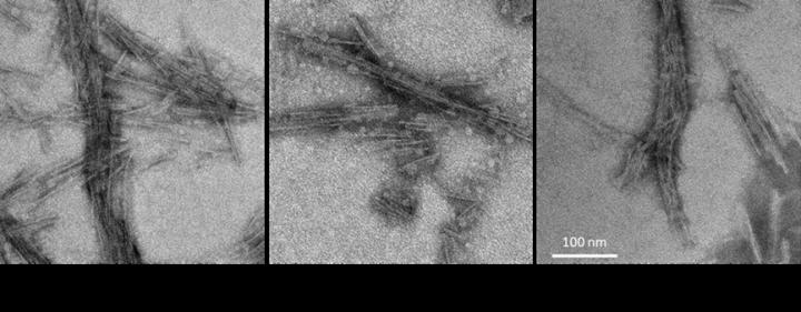 4R RT-QuIC Products Seeded with Brain Homogenates from Individuals