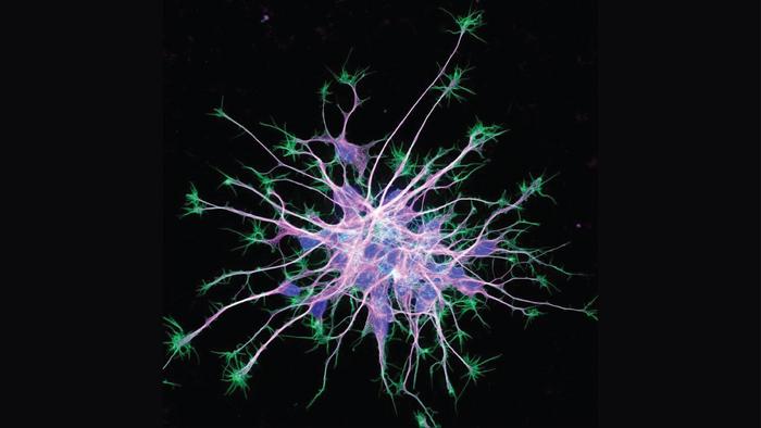 Neuronal Cytoskeleton