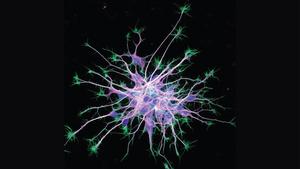 Neuronal Cytoskeleton