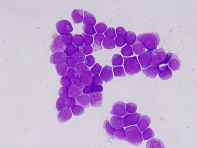 Acute Myelogenous Leukemia Cells