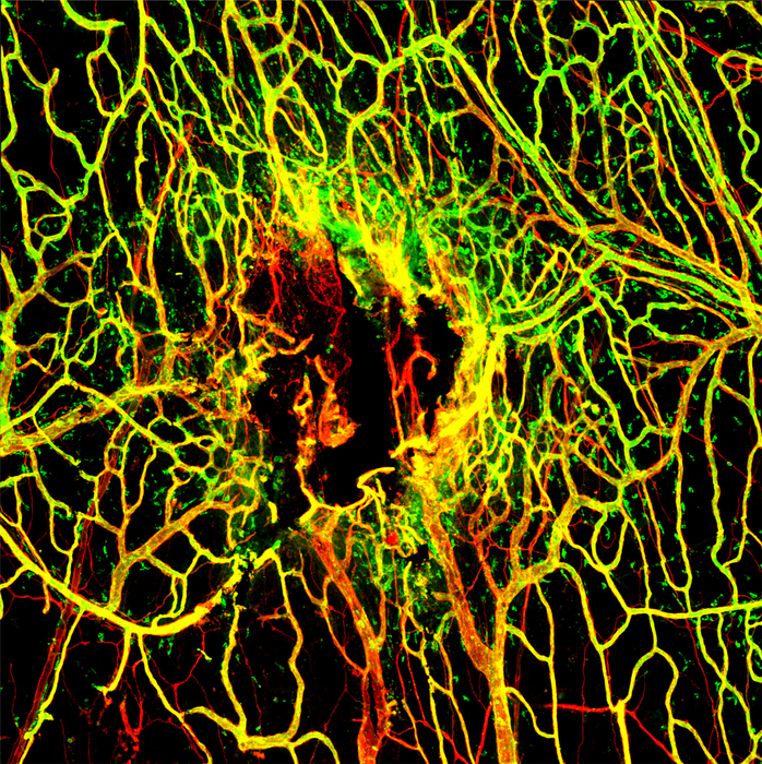 Viral Infection Slows Blood Vessel Repair After TBI