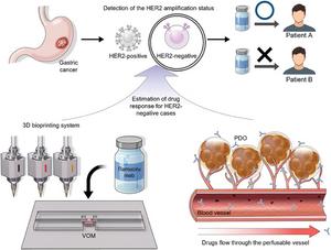 The gastric cancer model (VOM) faithfully reproduces the microscopic vasculature and in vivo environment of gastric cancer