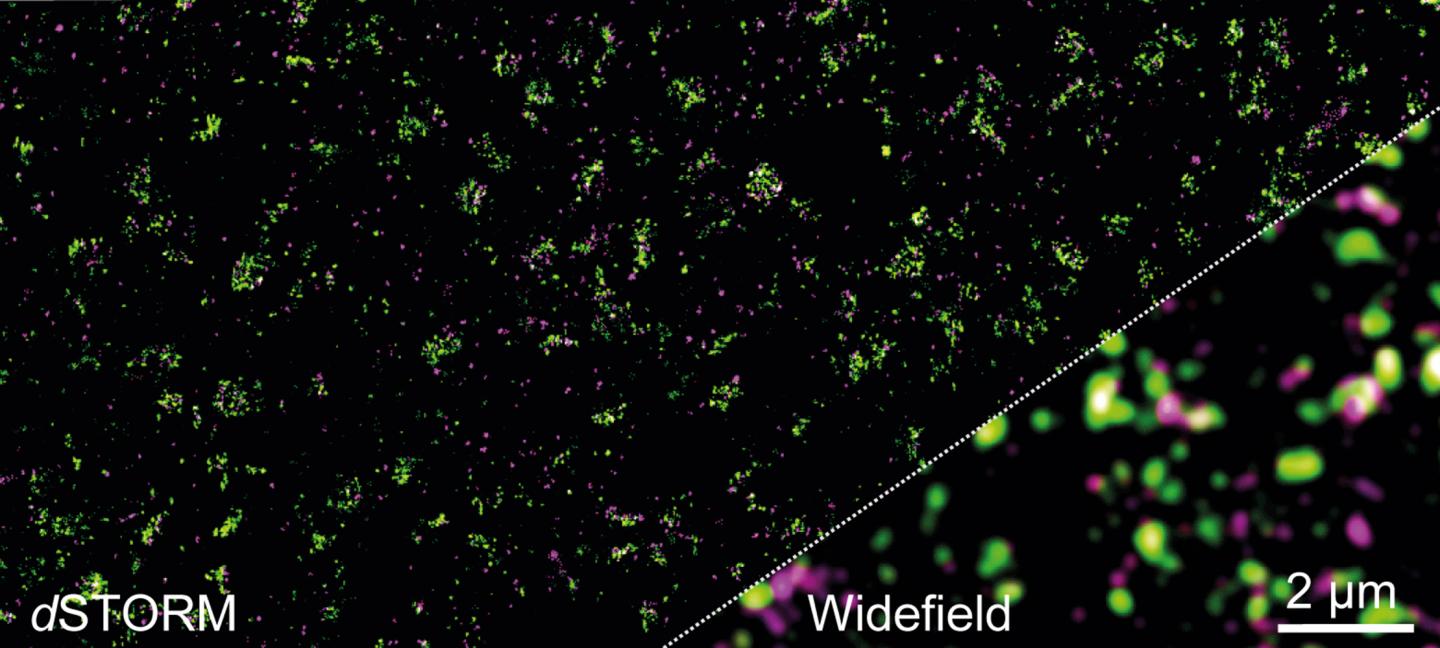 Super-Resolution Microscopy of the Synapses