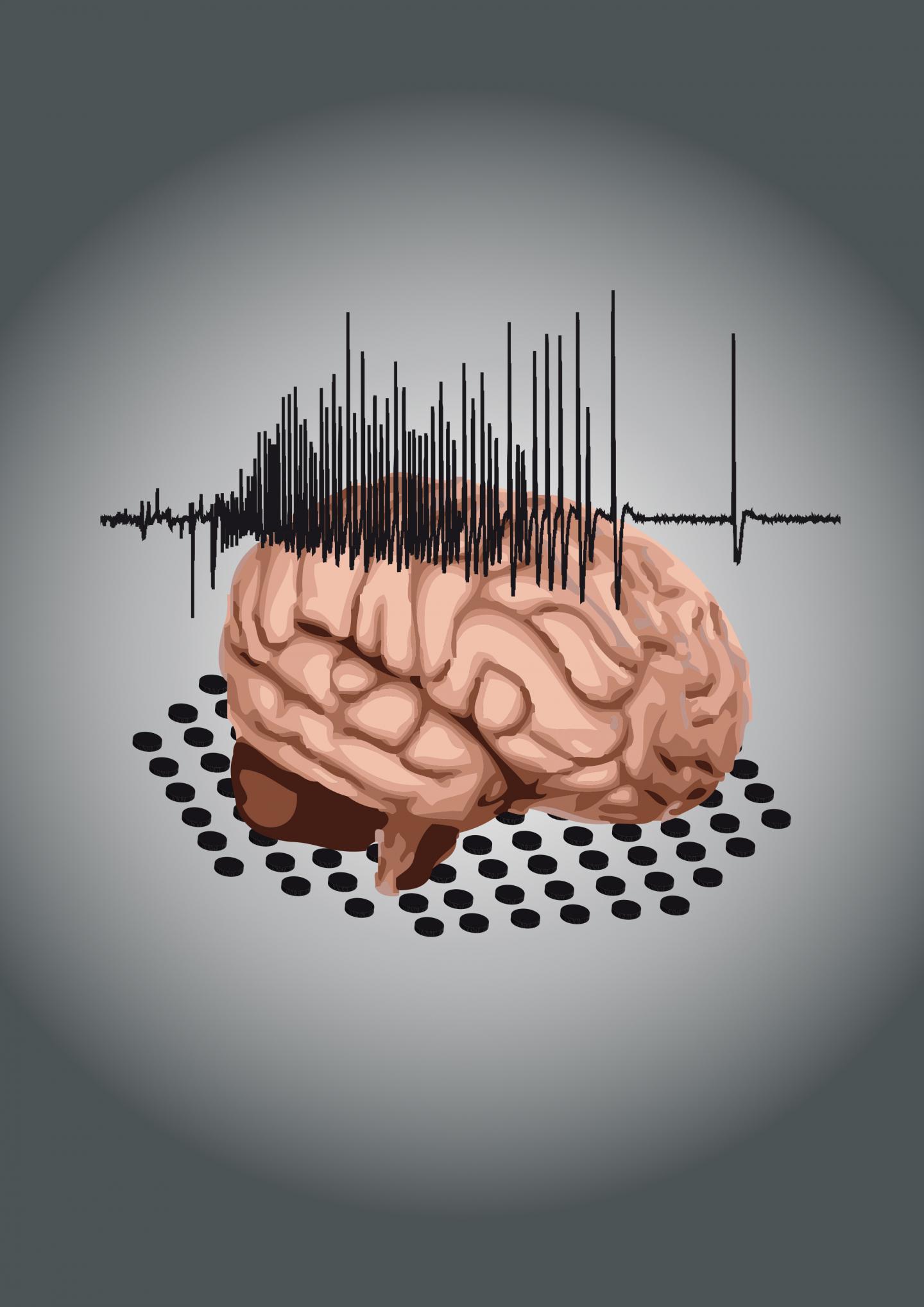 New Targets in the Treatment of Chronic Epilepsy (1 of 1)