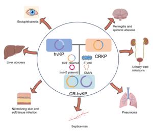 The formation mechanism of CR-hvKP and clinical presentation associated with CR-hvKP infection.