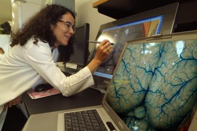 Dr. Adviye Ergul, Medical College of Georgia