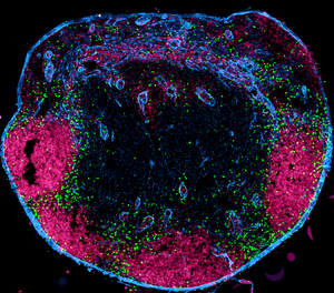 Cross-section through a lymph node