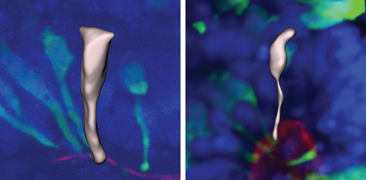 Human and gorilla neural progenitor cells