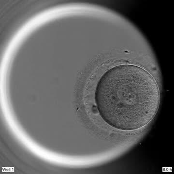 Unedited human embryo development