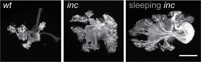 Insomniac fruit fly mutants show enhanced memory despite severe sleep loss