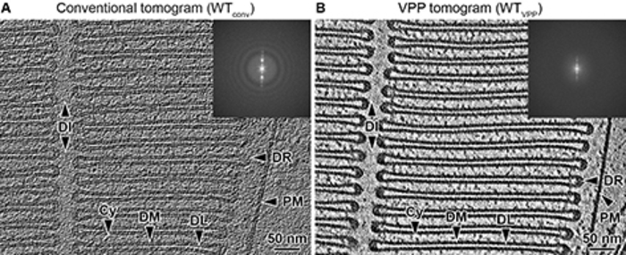 Visualizing individual proteins using cryo-ET with a Volta phase plate